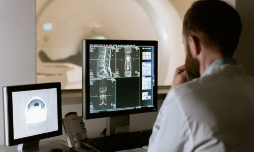 La Tomografia computerizzata Applicazioni standard ed avanzate in ambito clinico ed industriale [MA-1394]